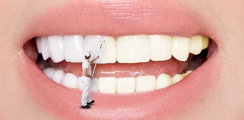 چگونه می توان به سرعت لکه های دندان را از بین برد؟