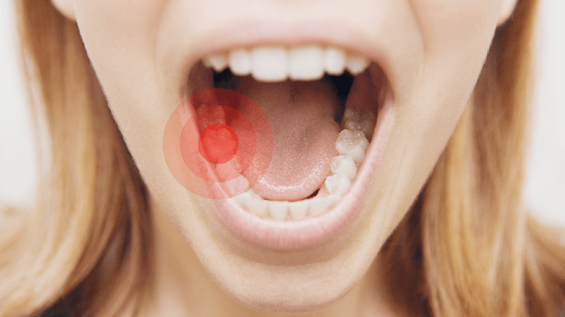 داروهای خانگی برای درمان 3 مشکل اصلی دهان و دندان