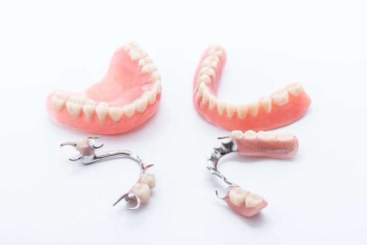 انواع مختلف پروتز دندان