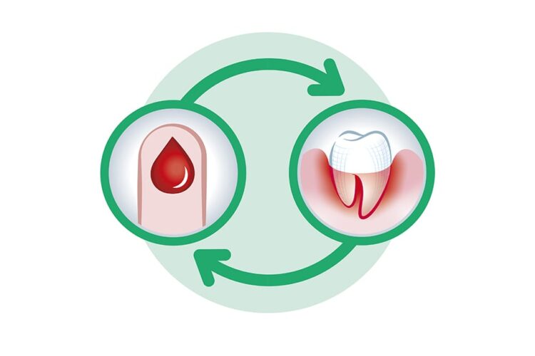 ارتباط میان دیابت و سلامت دهان و دندان