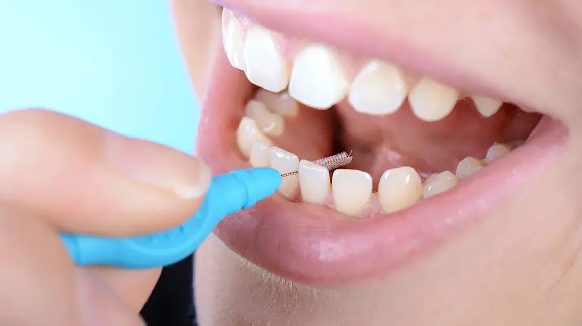 تمیز کردن بین دندان