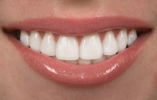 روکش (کراون) دندان